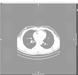 Replace a series or study
