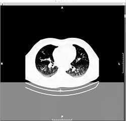 Add a series to the bottom