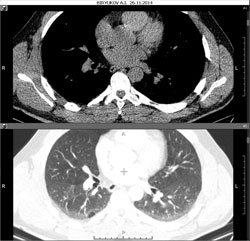 Add a series to the bottom