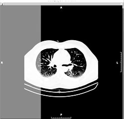 Add a series to the left