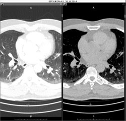 Add a series to the left