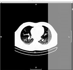 Add a series to the right