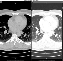 Add a series to the right