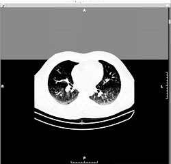 Add a series to the top