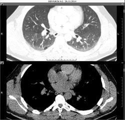 Add a series to the top