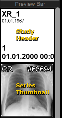 Preview Bar