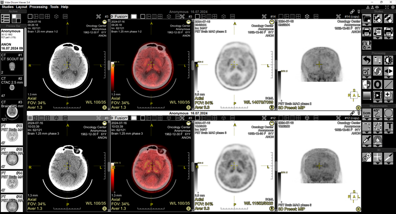 Vidar Dicom Viewer 3.4.3